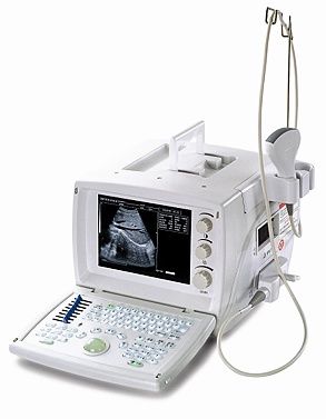 Ultrasound Scanner