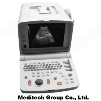 Ultrasound Scanner
