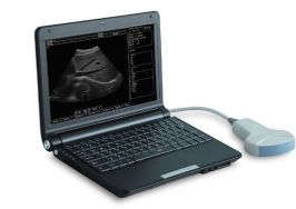 3000 Laptop Full Digital Ultrasound Scanner