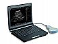 3000 Laptop Full Digital Ultrasound Scanner